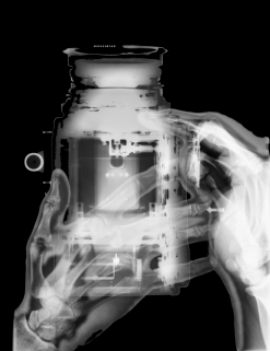 Rontgen Hasselblad
