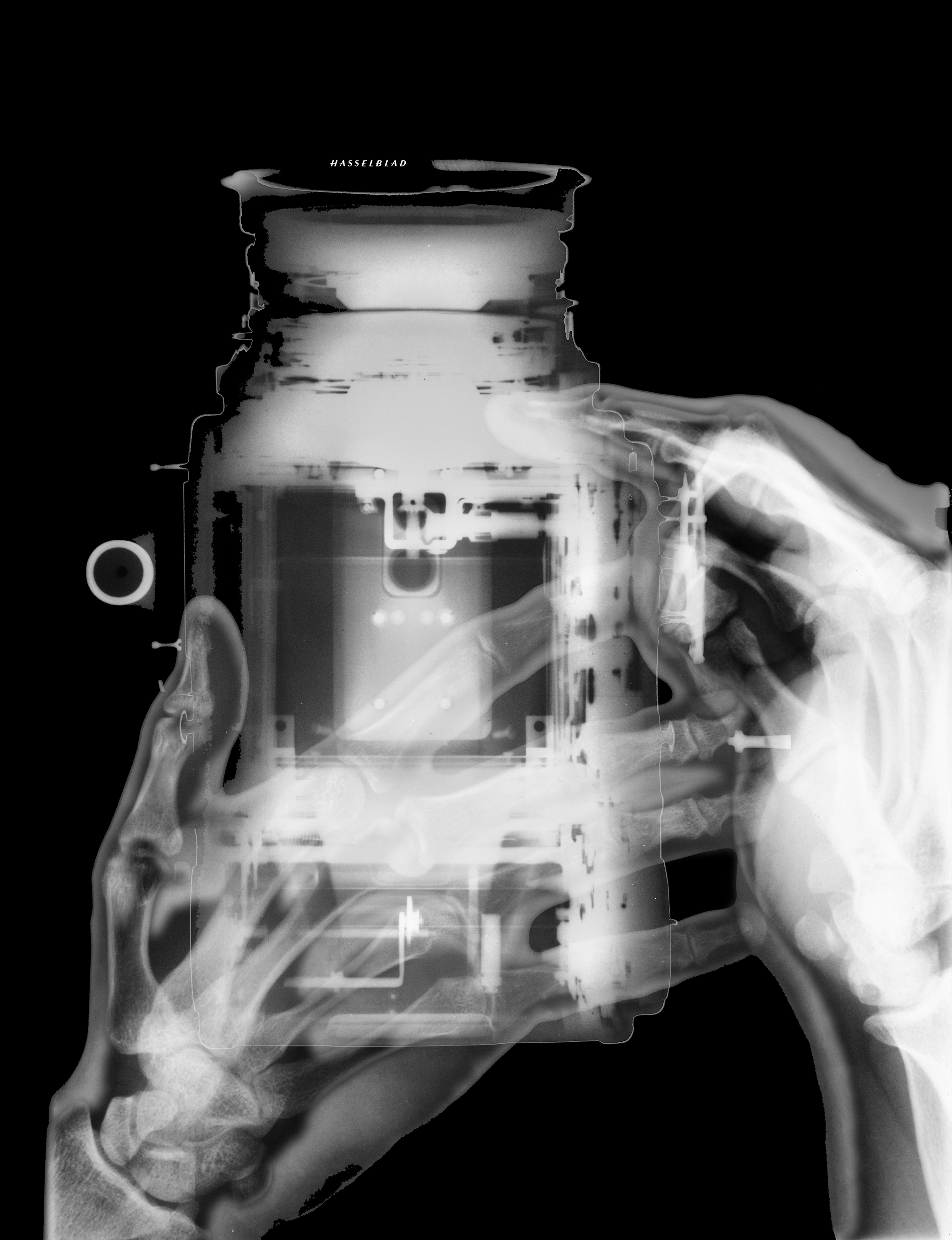 Rontgen Hasselblad