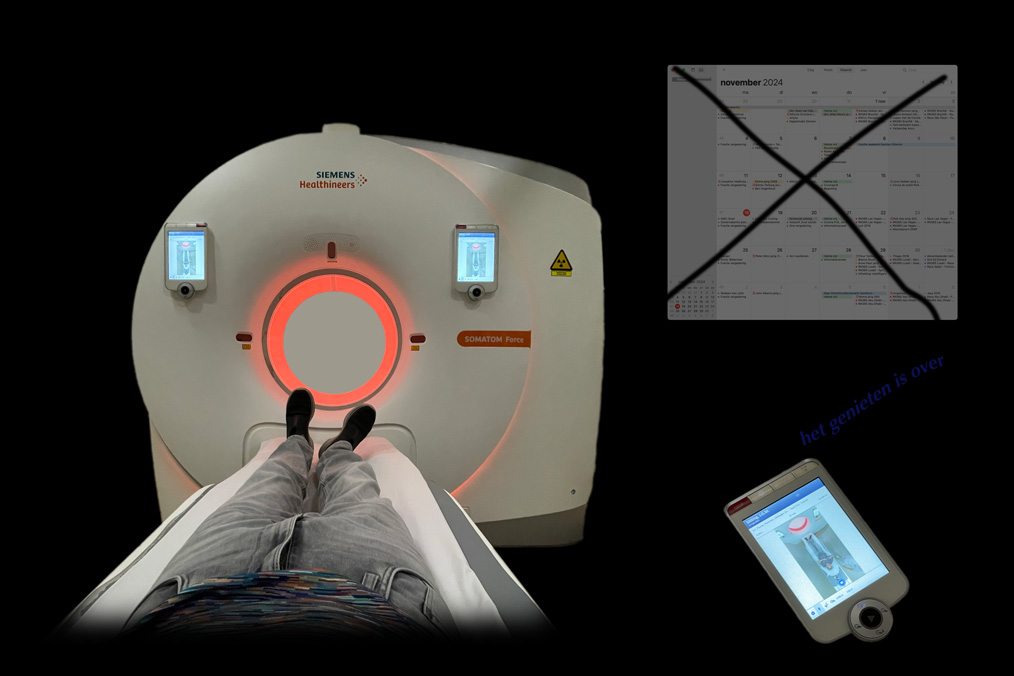 De scan